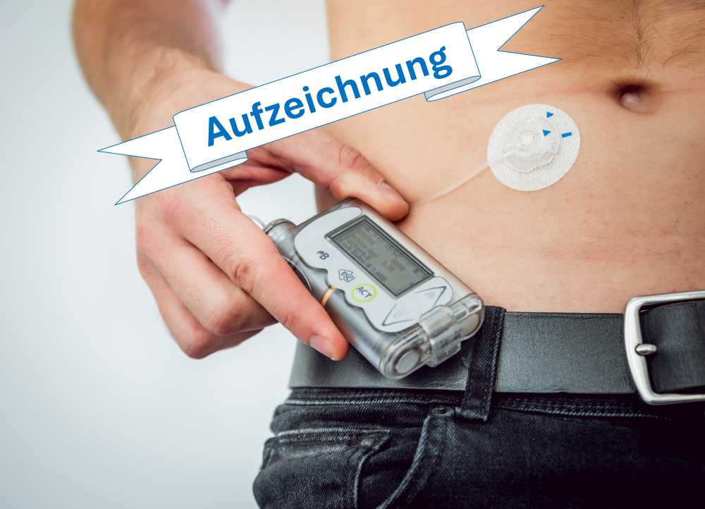AID-Systeme und Insulinpumpentherapie - Update 2026