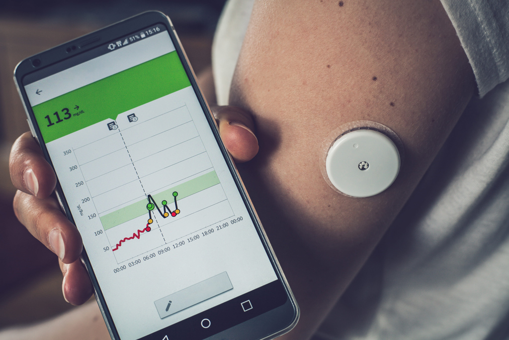 Interpretation des AGP